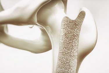 ترمیم بافت‌های استخوانی به کمک پلیمر طبیعی صمغ کندر