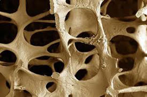 تولید داربست های استخوانی نانوکامپوزیتی هیدروژلی جهت ترمیم بافت های آسیب دیده