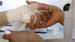 اسپری ضدباکتری آسیب‌های پوستی را درمان می‌کند