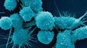 توسعه یک شبکه پلیمری میکروسکوپی برای مقابله با سرطان‌های بدخیم